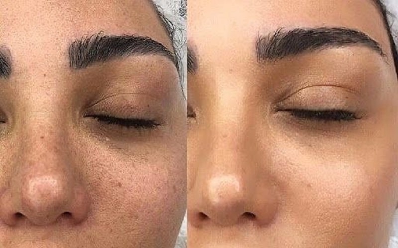 Makeup Tips to Minimize Pores