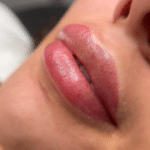 Essential Lip Care Routine